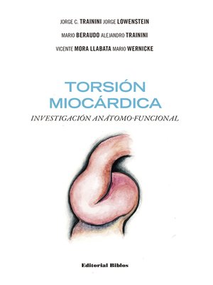 cover image of Torsión miocárdica